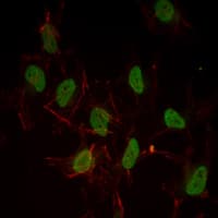 ER Alpha / Estrogen Receptor Antibody (clone 6B6)