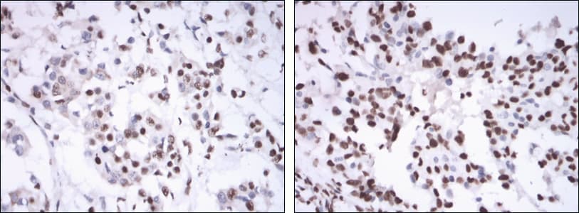 ER Alpha / Estrogen Receptor Antibody (clone 6B6)