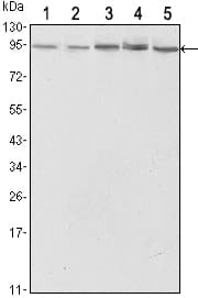 Monoclonal Mouse anti-Human STAT3 Antibody (clone 3B5, IHC, IF, WB)