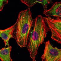 Monoclonal Mouse anti-Human STAT3 Antibody (clone 3B5, IHC, IF, WB)