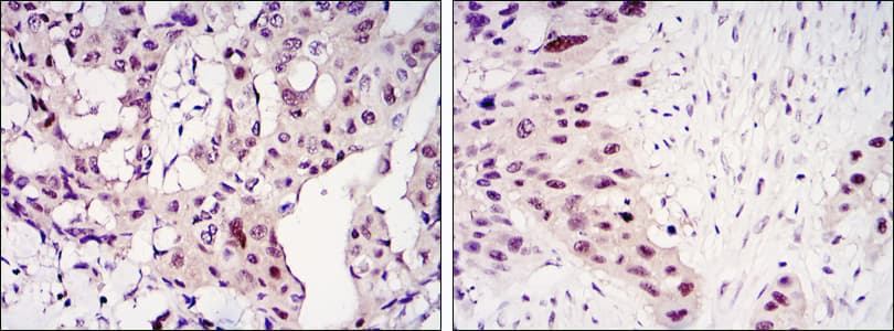 Monoclonal Mouse anti-Human STAT3 Antibody (clone 3B5, IHC, IF, WB)