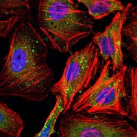 CCNB1 / Cyclin B1 Antibody (clone 5G6)