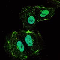 Monoclonal Mouse anti-Human OPG / Osteoprotegerin Antibody (clone 5G2, IF, WB)