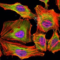 Monoclonal Mouse anti-Human KDM3A / JMJD1A Antibody (clone 20, IHC, IF, WB)