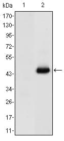 CEA / Carcinoembryonic Antigen Antibody (clone 3G12)