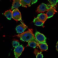 CEA / Carcinoembryonic Antigen Antibody (clone 3G12)
