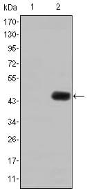 CEA / Carcinoembryonic Antigen Antibody (clone 1C7)