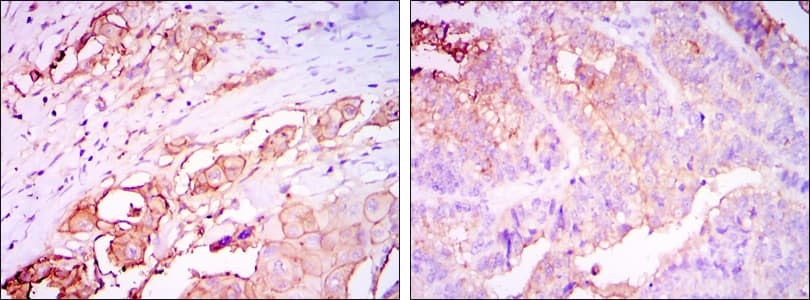 CEA / Carcinoembryonic Antigen Antibody (clone 1C7)