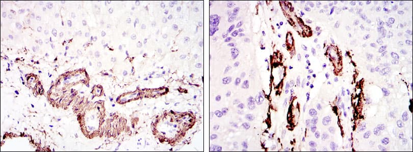 ACTA2 / Smooth Muscle Actin Antibody (clone 4F4)