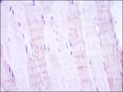 MAP2K4 / MKK4 Antibody (clone 5H4)
