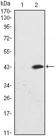 Monoclonal Mouse anti-Human ATM Antibody (clone 5C5, aa2705-2820, WB)