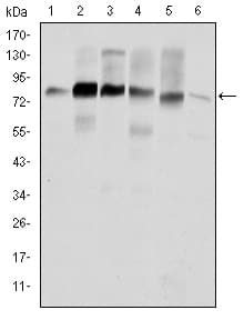 Monoclonal Mouse anti-Human CTTN / Cortactin Antibody (clone 4C6, IHC, WB)