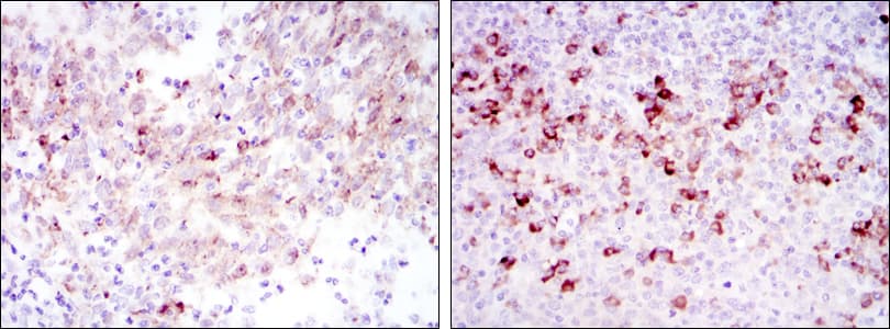 Monoclonal Mouse anti-Human CTTN / Cortactin Antibody (clone 4C6, IHC, WB)