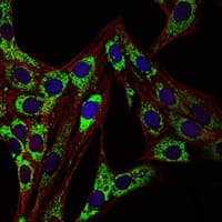 HSPD1 / HSP60 Antibody (clone 3G8)