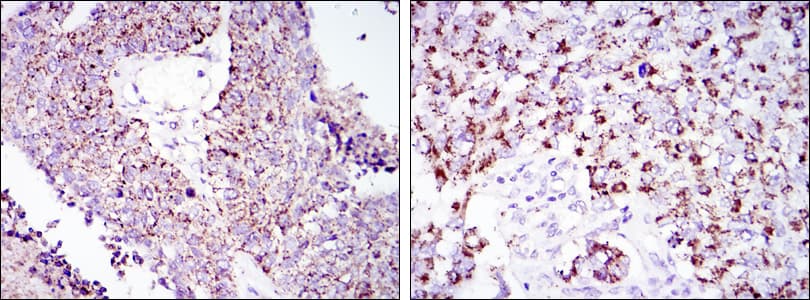 HSPD1 / HSP60 Antibody (clone 3G8)