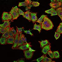 RBP4 Antibody (clone 4C2)