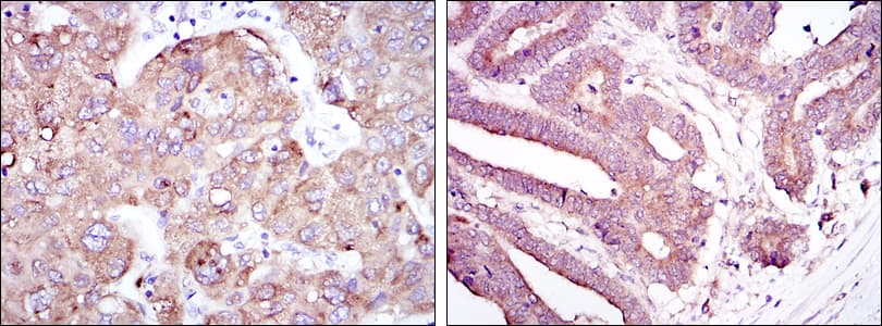 RBP4 Antibody (clone 4C2)