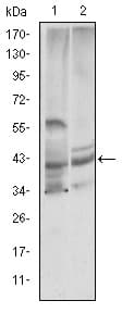 CST3 / Cystatin C Antibody (clone 5H2)
