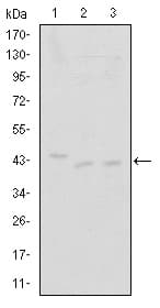 Monoclonal Mouse anti-Human CDK9 Antibody (clone 1B5D10, IHC, WB)