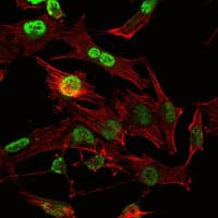 Monoclonal Mouse anti-Human OTX2 Antibody (clone 1H12G8B2, IHC, IF, WB)