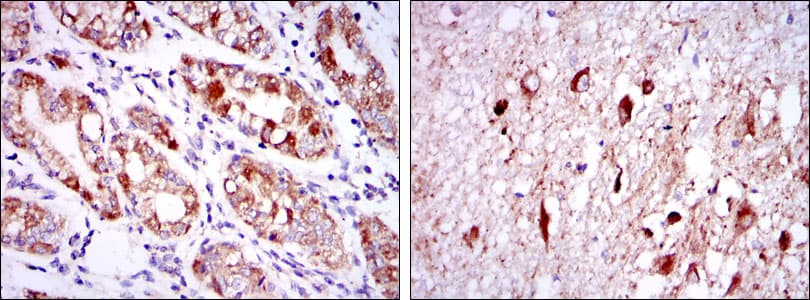 Monoclonal Mouse anti-Human OTX2 Antibody (clone 1H12G8B2, IHC, IF, WB)