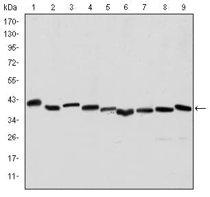 ACTA2 / Smooth Muscle Actin Antibody (clone 4A4)