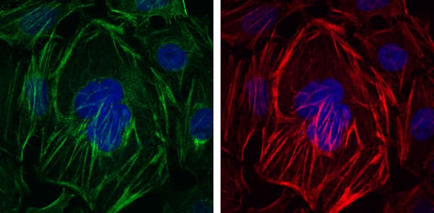ACTA2 / Smooth Muscle Actin Antibody (clone 4A4)