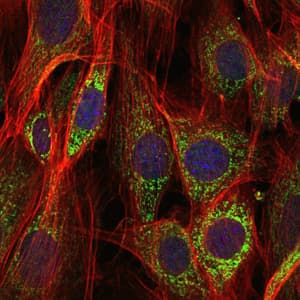 Monoclonal Mouse anti-Human AIFM1 / AIF / PDCD8 Antibody (clone 4E7, IHC, IF, WB)