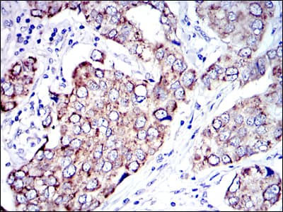 Monoclonal Mouse anti-Human AIFM1 / AIF / PDCD8 Antibody (clone 4E7, IHC, IF, WB)