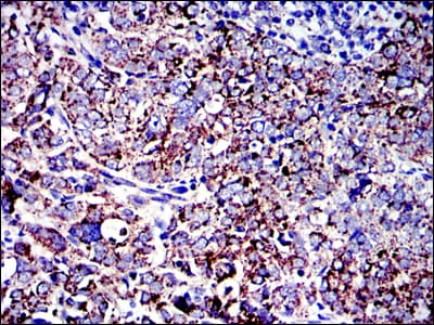 Monoclonal Mouse anti-Human AIFM1 / AIF / PDCD8 Antibody (clone 4E7, IHC, IF, WB)