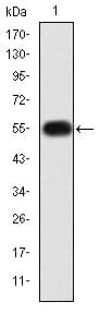 MMP9 / Gelatinase B Antibody (clone 5C3)
