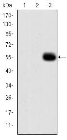 MMP9 / Gelatinase B Antibody (clone 5C3)