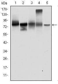 Monoclonal Mouse anti-Human JUP/CTNNG/Junction Plakoglobin Antibody (clone 4C12, IHC, IF, WB)
