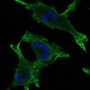 Monoclonal Mouse anti-Human JUP/CTNNG/Junction Plakoglobin Antibody (clone 4C12, IHC, IF, WB)