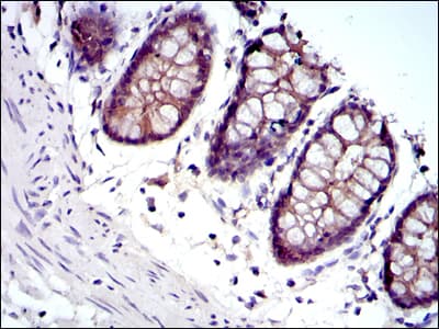 Monoclonal Mouse anti-Human JUP/CTNNG/Junction Plakoglobin Antibody (clone 4C12, IHC, IF, WB)