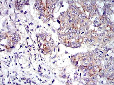 Monoclonal Mouse anti-Human JUP/CTNNG/Junction Plakoglobin Antibody (clone 4C12, IHC, IF, WB)