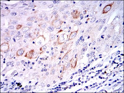 Monoclonal Mouse anti-Human MAP2K7 / MEK7 Antibody (clone 4E5, IHC, IF, WB)