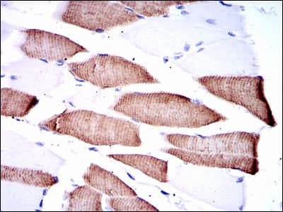 Monoclonal Mouse anti-Human MAP2K7 / MEK7 Antibody (clone 4E5, IHC, IF, WB)