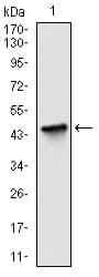 Monoclonal Mouse anti-Human BIRC5 / Survivin Antibody (clone 1H5, IHC, IF, WB)