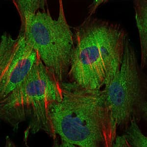 Monoclonal Mouse anti-Human BIRC5 / Survivin Antibody (clone 1H5, IHC, IF, WB)