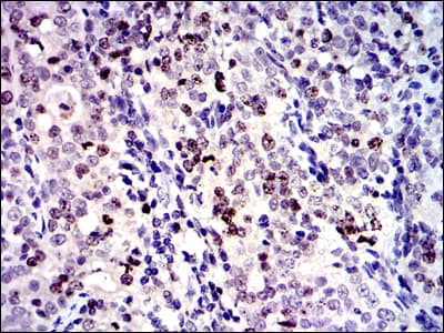 Monoclonal Mouse anti-Human BIRC5 / Survivin Antibody (clone 1H5, IHC, IF, WB)