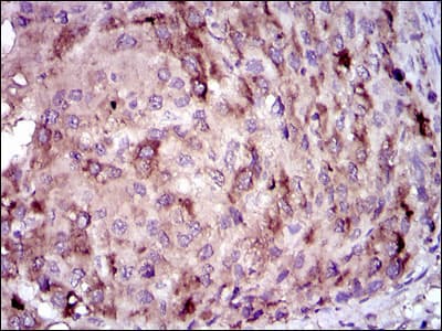 Monoclonal Mouse anti-Human CRP / C-Reactive Protein Antibody (clone 1G1, IHC, WB)