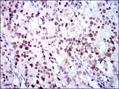 CDK2 Antibody (aa197-295, clone 1A6)
