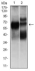 Monoclonal Mouse anti-Human HEXA Antibody (clone 3F10, WB)