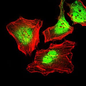 PathPlus™ KRT5 / CK5 / Cytokeratin 5 Antibody (aa158-272, clone 2C2)
