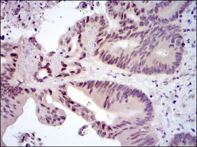Monoclonal Mouse anti-Human FOS / c-FOS Antibody (clone 2G2, IHC, WB)