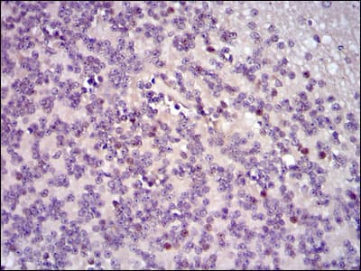 Monoclonal Mouse anti-Human FOS / c-FOS Antibody (clone 2G2, IHC, WB)
