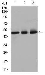 Monoclonal Mouse anti-Human E2F1 Antibody (clone 8G9, IHC, WB)