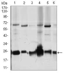 Monoclonal Mouse anti-Human ARHGDIA / RHOGDI Antibody (clone 2G3, IF, WB)
