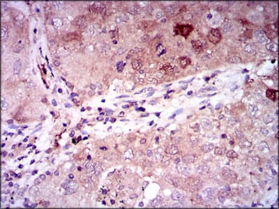 ENO2 / NSE Antibody (clone 5D3)